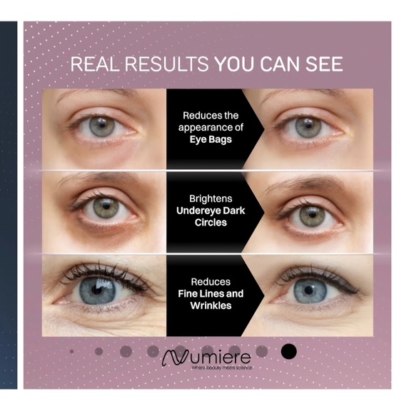 Numiere Feather LED Mask - Picture 4 of 14